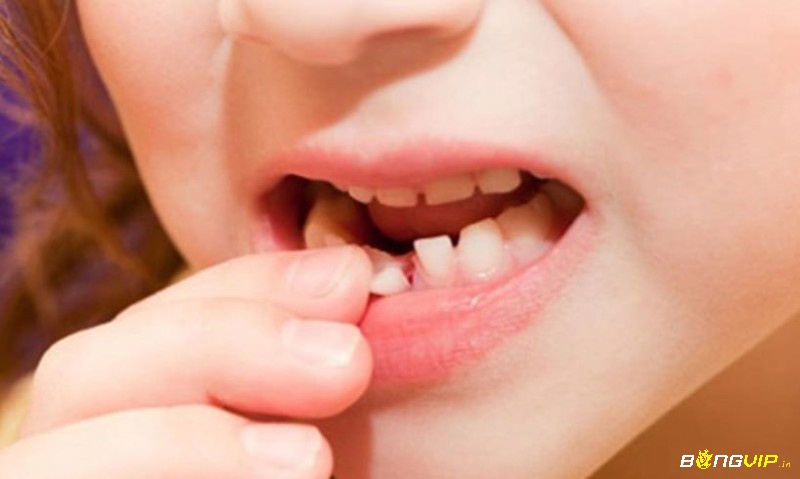 Mơ gãy răng là điềm báo gì thấy răng cửa gãy trong giấc mơ – lời cảnh báo về sự tổn thương hình ảnh cá nhân và những bất an trong giao tiếp