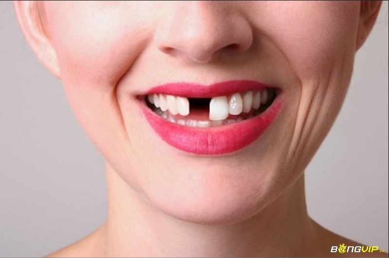 Gãy răng có đau không – tín hiệu phản ánh khả năng thích nghi và chấp nhận biến động cuộc sống