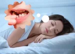 Giải mã giấc mơ thấy gãy răng điềm gì? Đánh đề số gì?